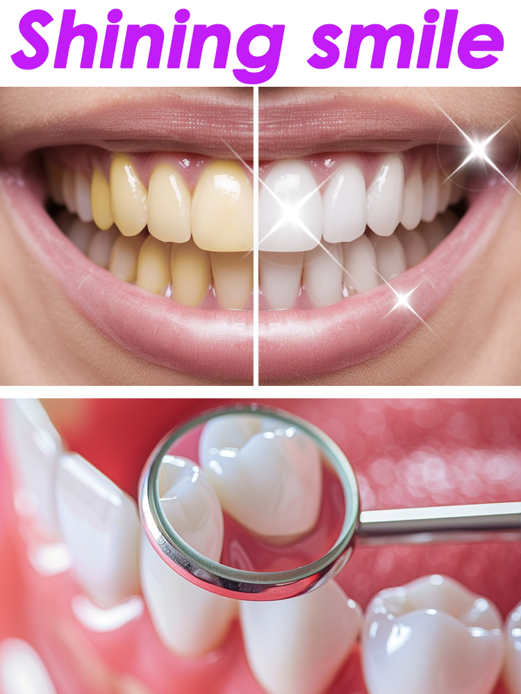 Teeth Whitening Xylitol - 글로리 스마일 치아 미백 과일향 치약