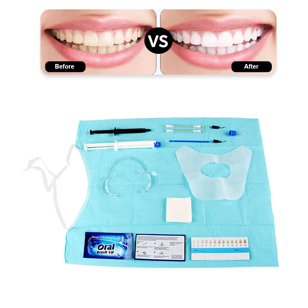 치과의사 클리닉 치아 미백 키트, 35% HP 이중 배 - Teeth Whitening Gingival Barrier 리뷰 및 가격