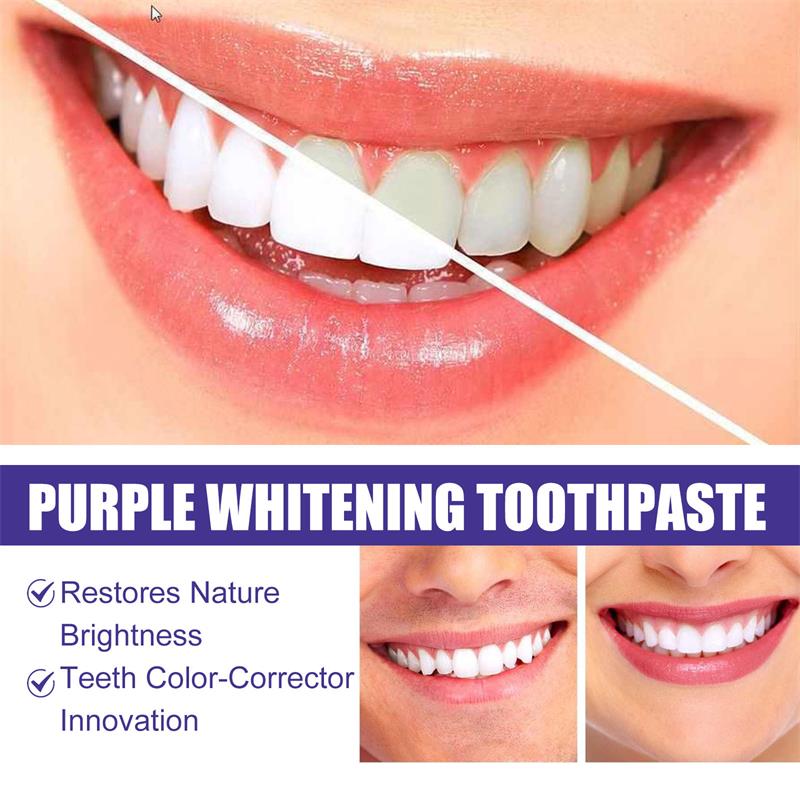 9D 퍼플 치아 미백 치약 무스, 누런 치아 및 플라그 - Teeth Whitening Cream 리뷰 및 가격