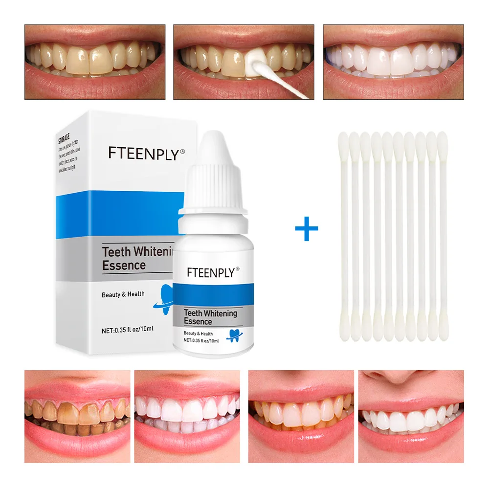 FTEENPLY 치아 미백 에센스 파우더 구강 위생 청 - Teeth Whitening Near Me 리뷰 및 가격