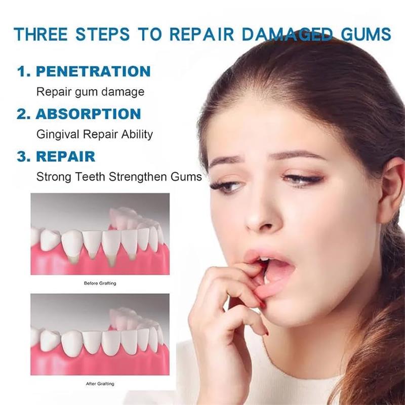 잇몸 복구 케어 세럼, 잇몸 충혈 완화, 치아 손상 감 - Teeth Whitening Gingival Barrier 리뷰 및 가격