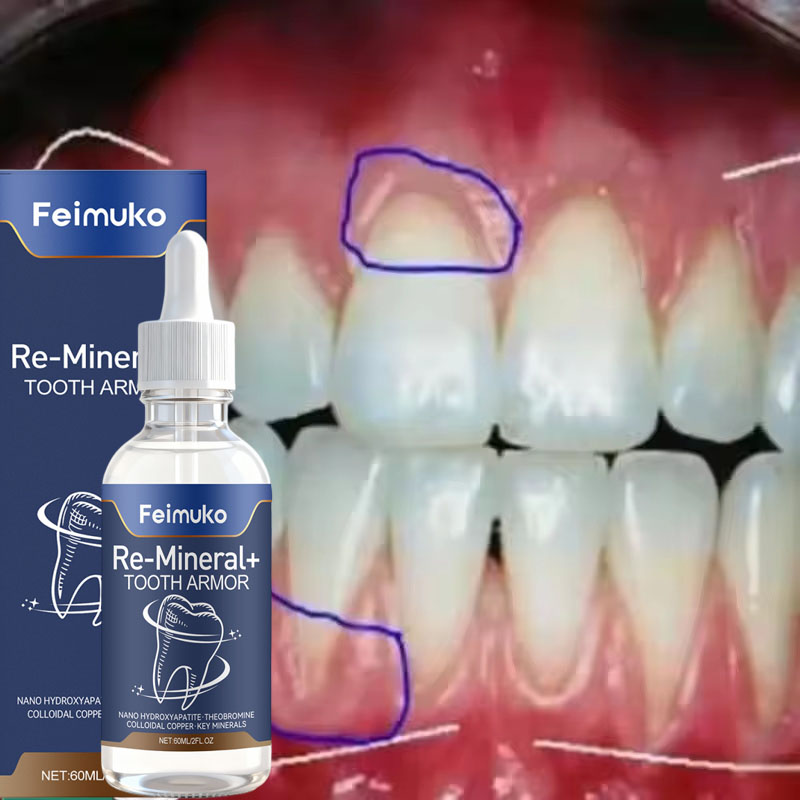 잇몸 복구 케어 세럼, 잇몸 충혈 완화, 치아 손상 감 - Teeth Whitening Gingival Barrier 리뷰 및 가격