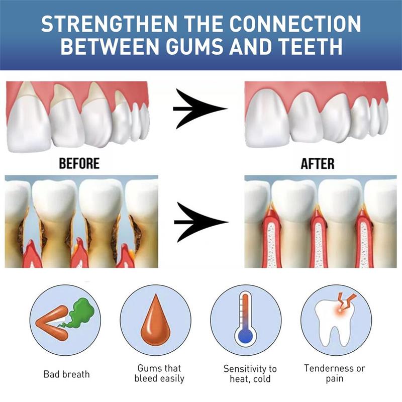 잇몸 복구 케어 세럼, 잇몸 충혈 완화, 치아 손상 감 - Teeth Whitening Gingival Barrier 리뷰 및 가격