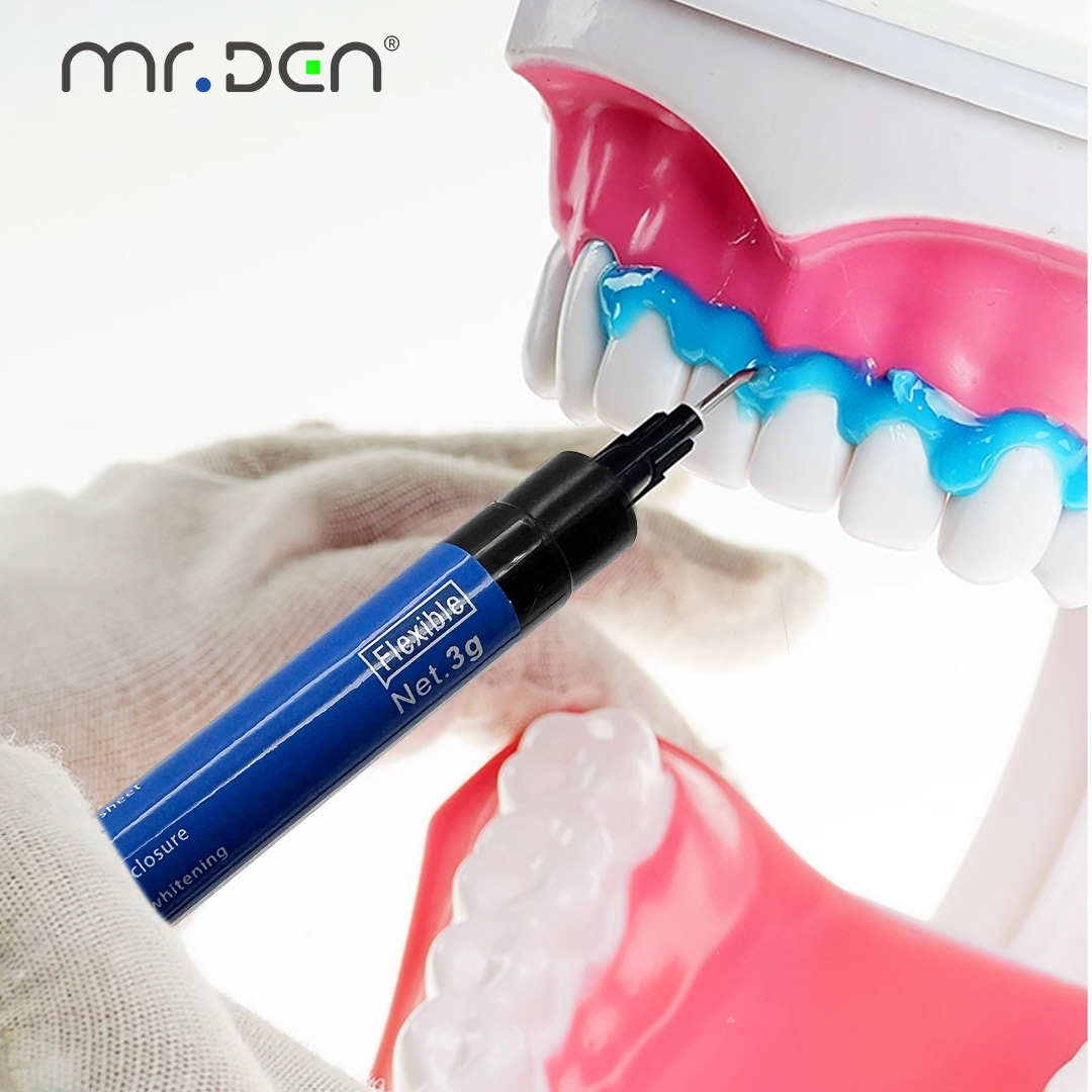 치아 잇몸 보호기 블루 배리어 광중합 레진 빠른 경화  - Teeth Whitening Gingival Barrier 리뷰 및 가격