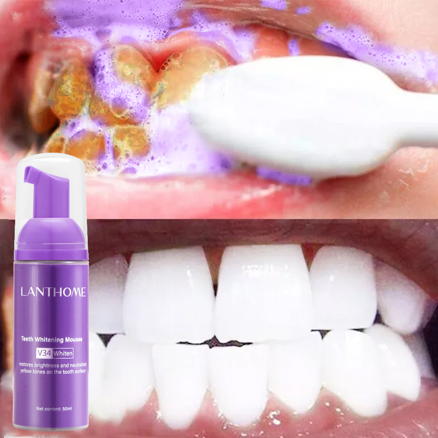 V34 치아 미백 무스 치약 플라그 제거 얼룩 제거 구 - Teeth Whitening Xylitol 리뷰 및 가격