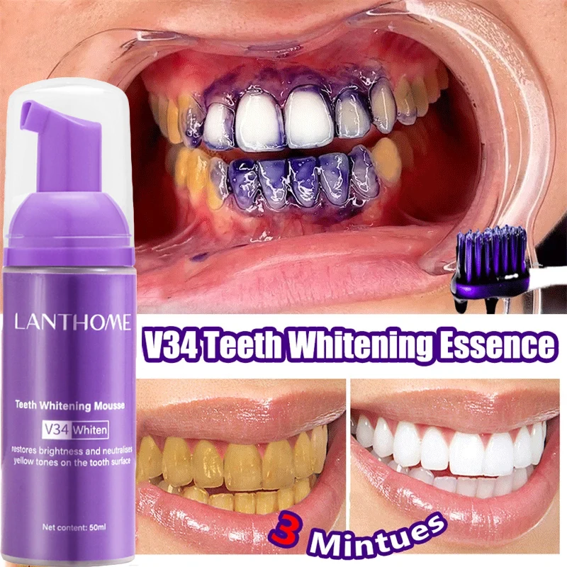 V34 치아 미백 무스 치약 플라그 제거 얼룩 제거 구 - Teeth Whitening Xylitol 리뷰 및 가격