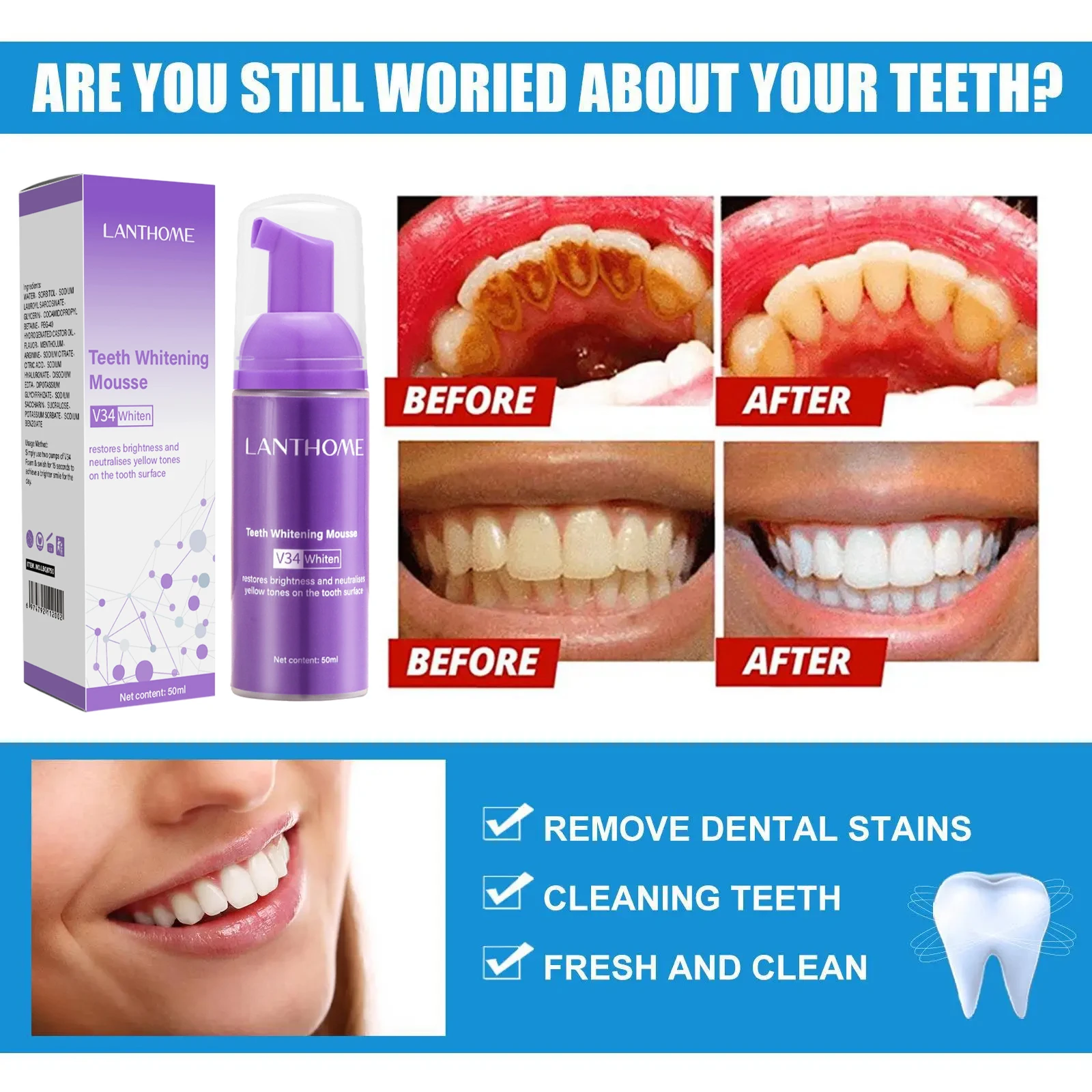 V34 치아 미백 무스 치약 플라그 제거 얼룩 제거 구 - Teeth Whitening Xylitol 리뷰 및 가격