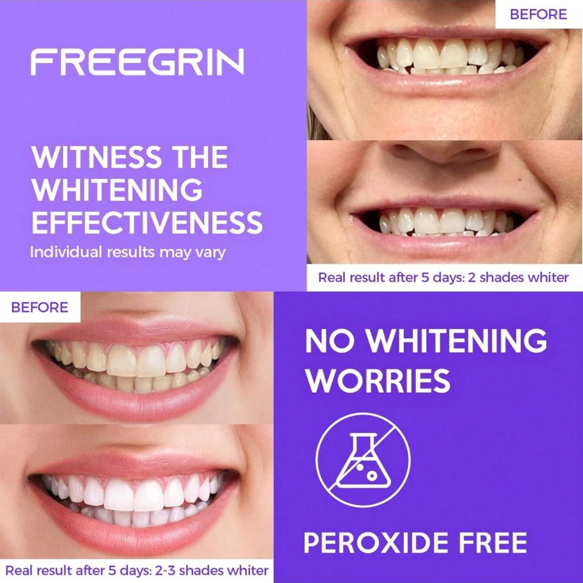 디럭스 화이트닝 치아 스티커 7/14/21 쌍 젤 화이 - Teeth Whitening Near Me 리뷰 및 가격