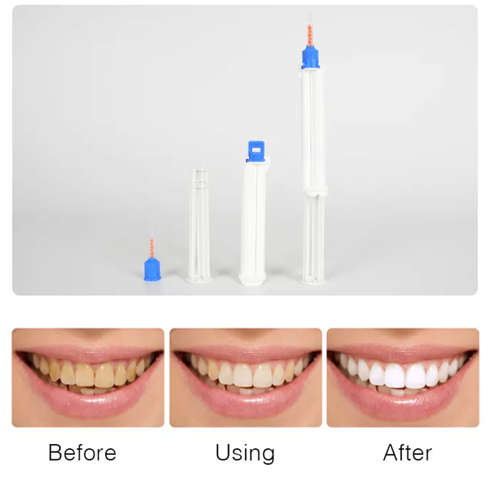 10/5/2개 치과용 듀얼 배럴 주사기 치아 미백 젤  - Teeth Whitening Gingival Barrier 리뷰 및 가격