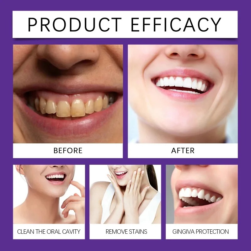 퍼플 치아 복원 미네랄 파우더 브라이트닝 화이트닝 에나 - Teeth Whitening Groupon 리뷰 및 가격